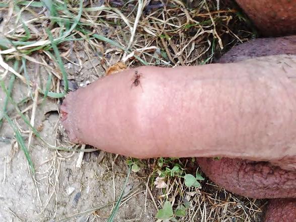 20P Ants on my penis