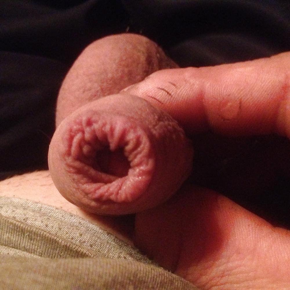 25P Mi penis