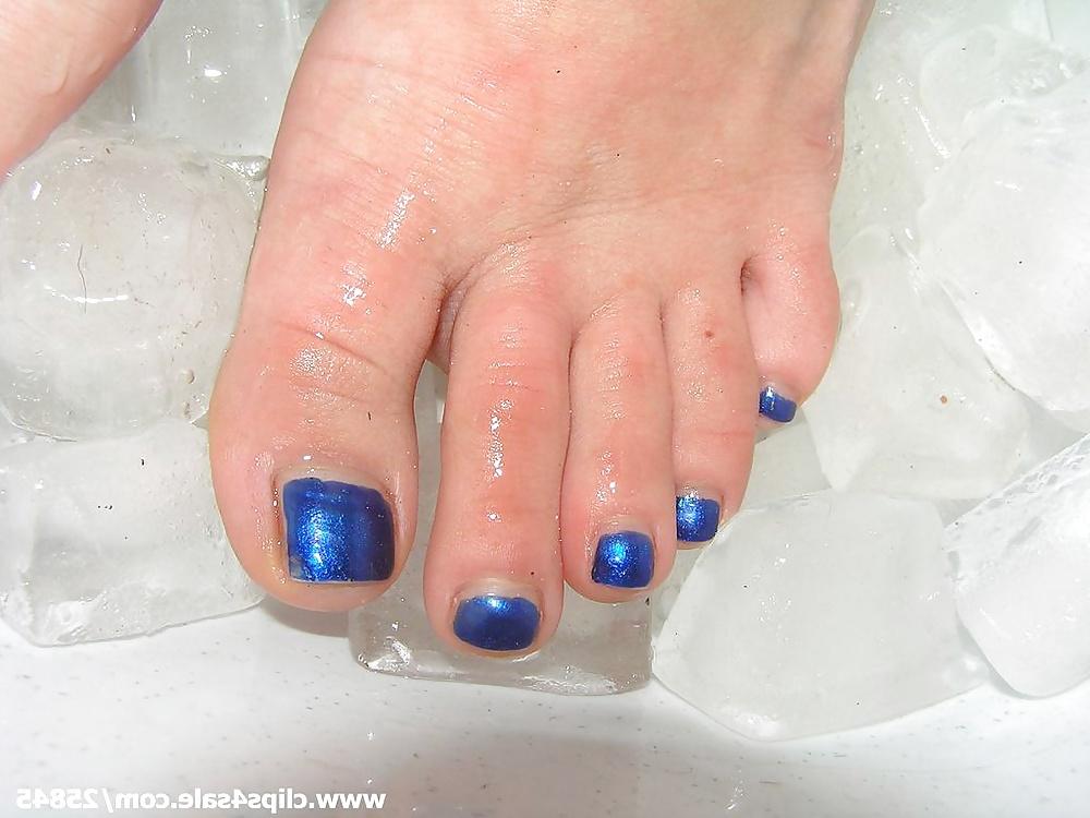 18P Ice Foot Torture