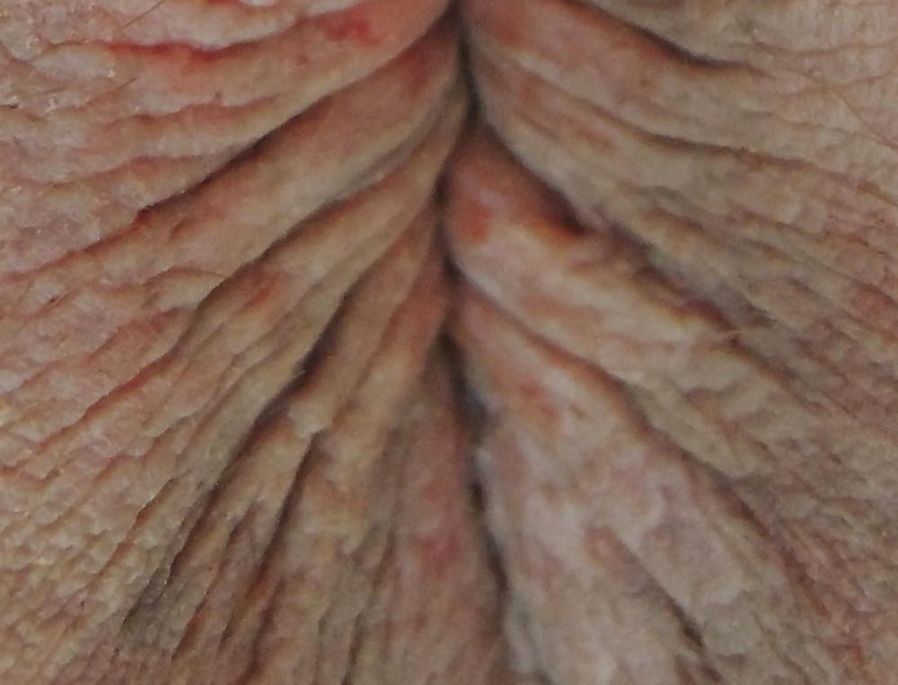 13P My butthole