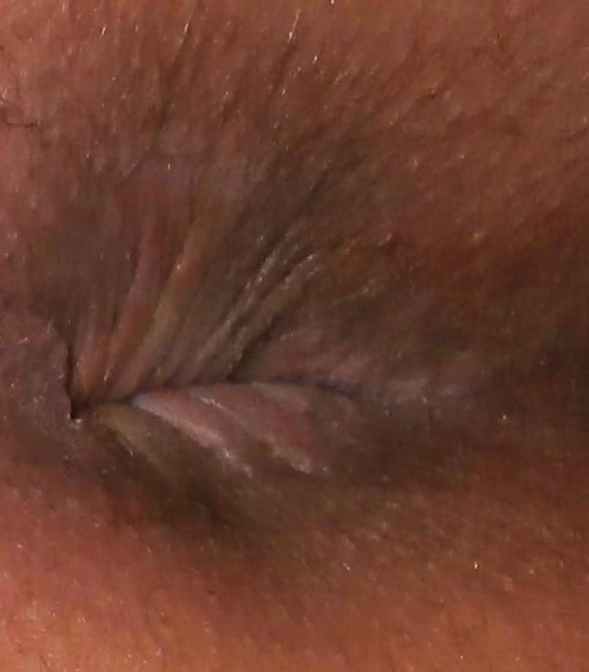13P My butthole