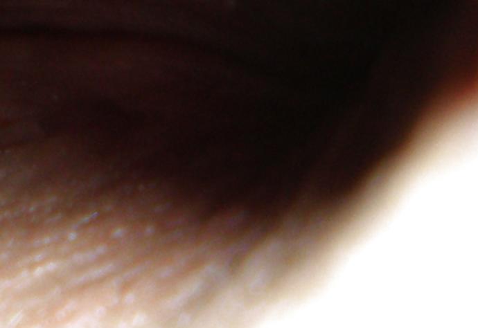 13P My butthole