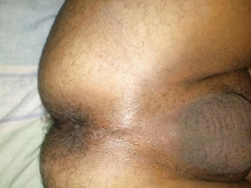 25P MI PENE