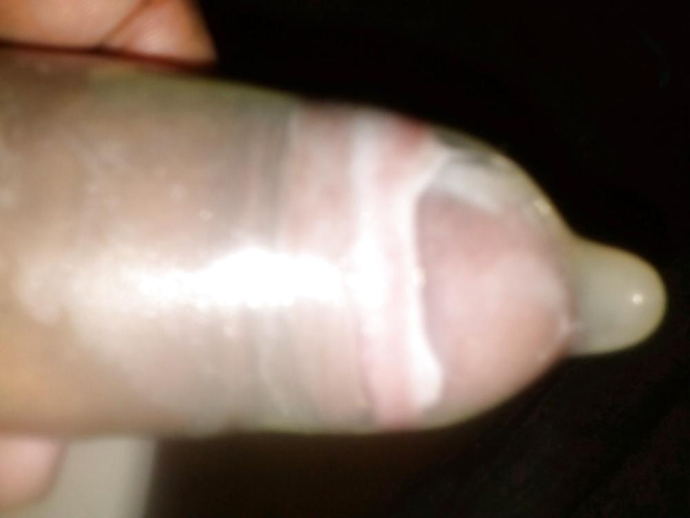 25P MI PENE