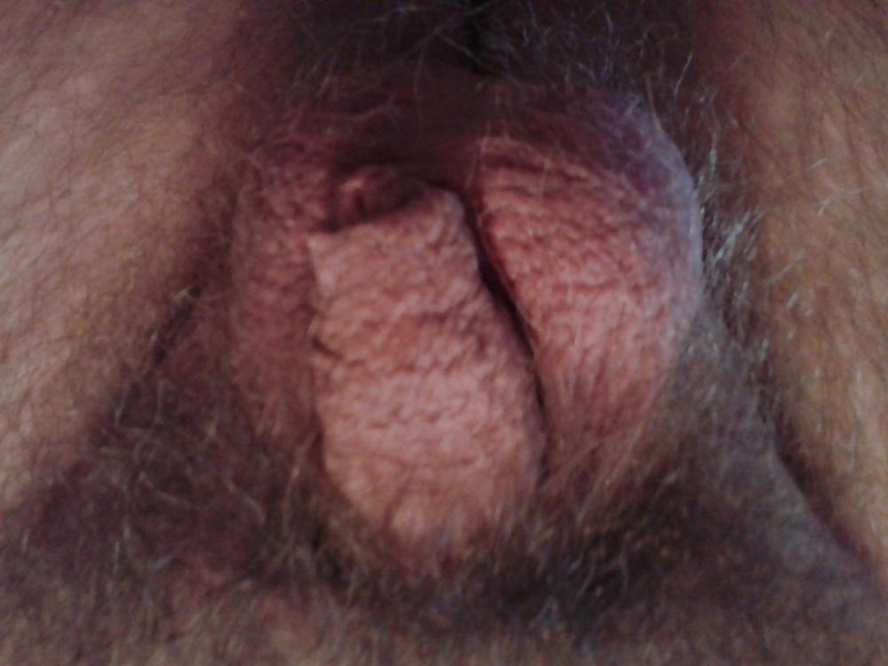 5P Kleiner penis