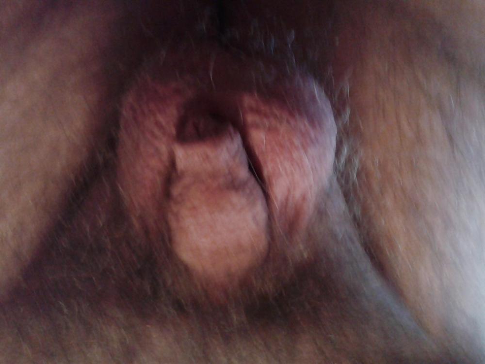 5P Kleiner penis
