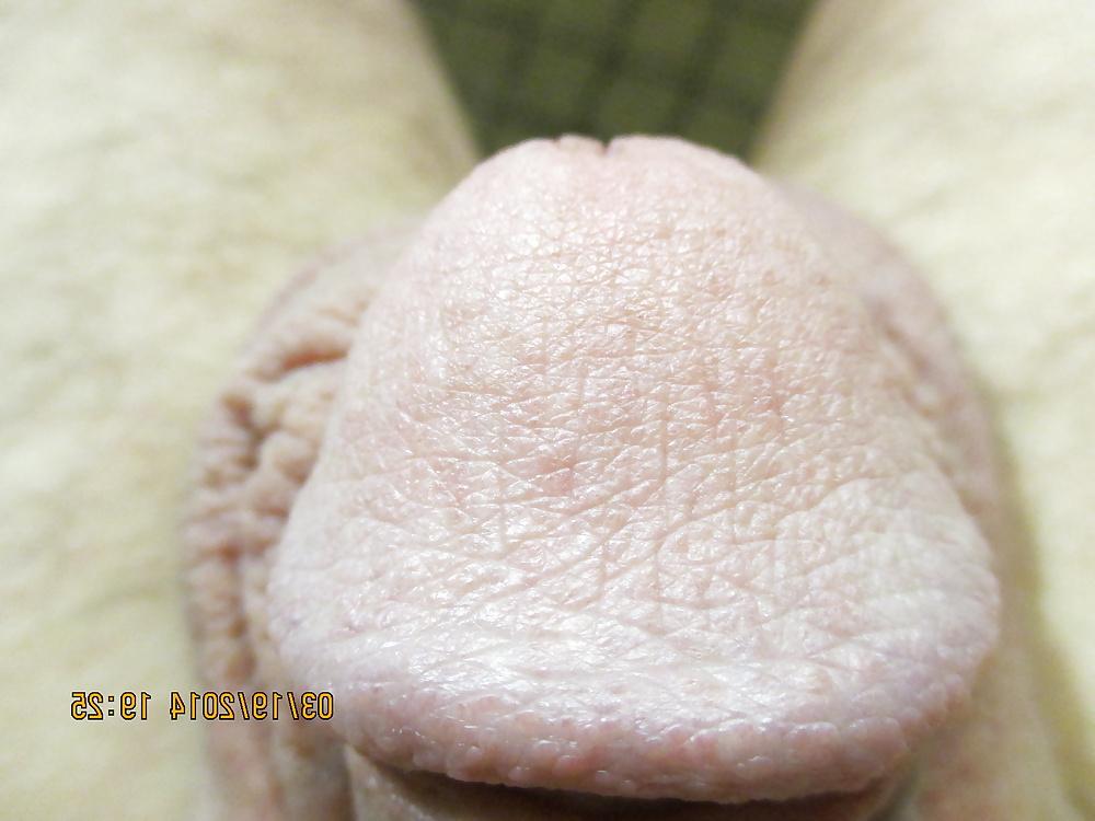 15P Macro-Penis