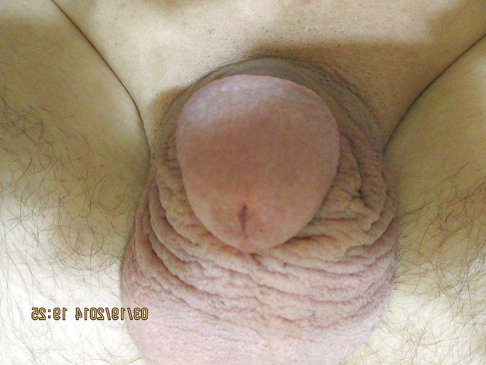 15P Macro-Penis