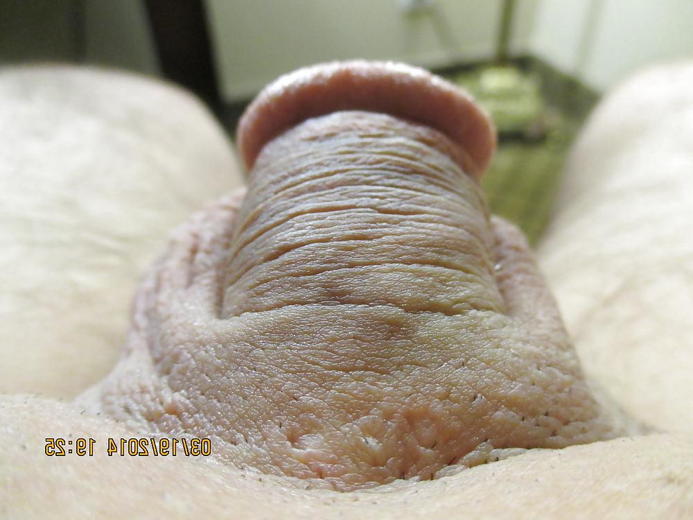15P Macro-Penis