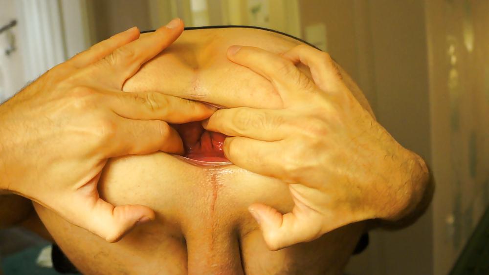6P Spreading my asshole after gaping and prolapse