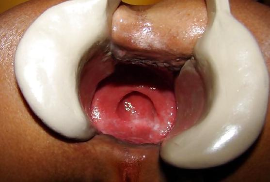 5P Asshole opened up wide