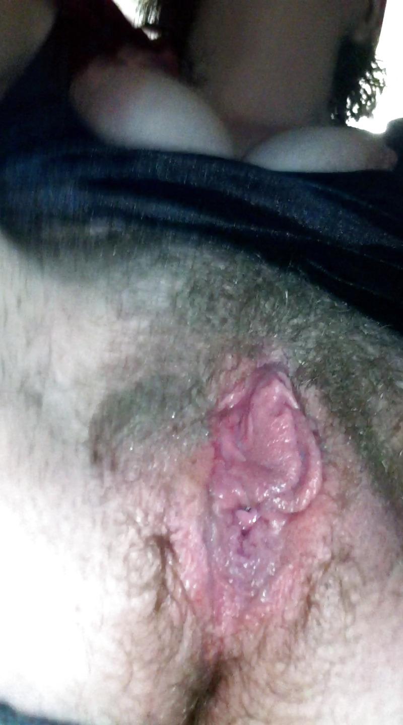 7P Mrs. hairy plump before and after