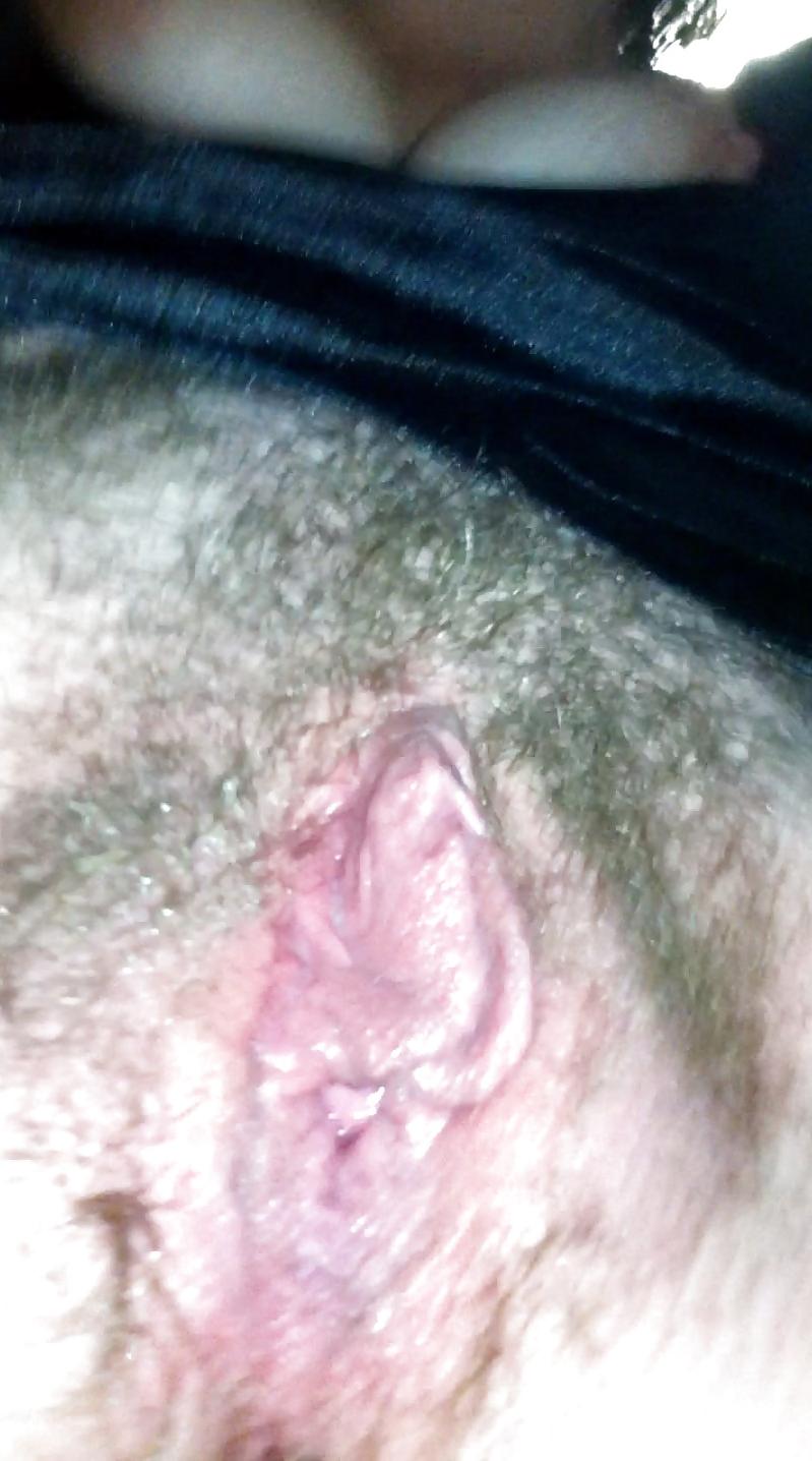 7P Mrs. hairy plump before and after