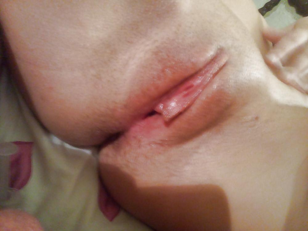 8P In Honor of My XW's Hairy Asshole