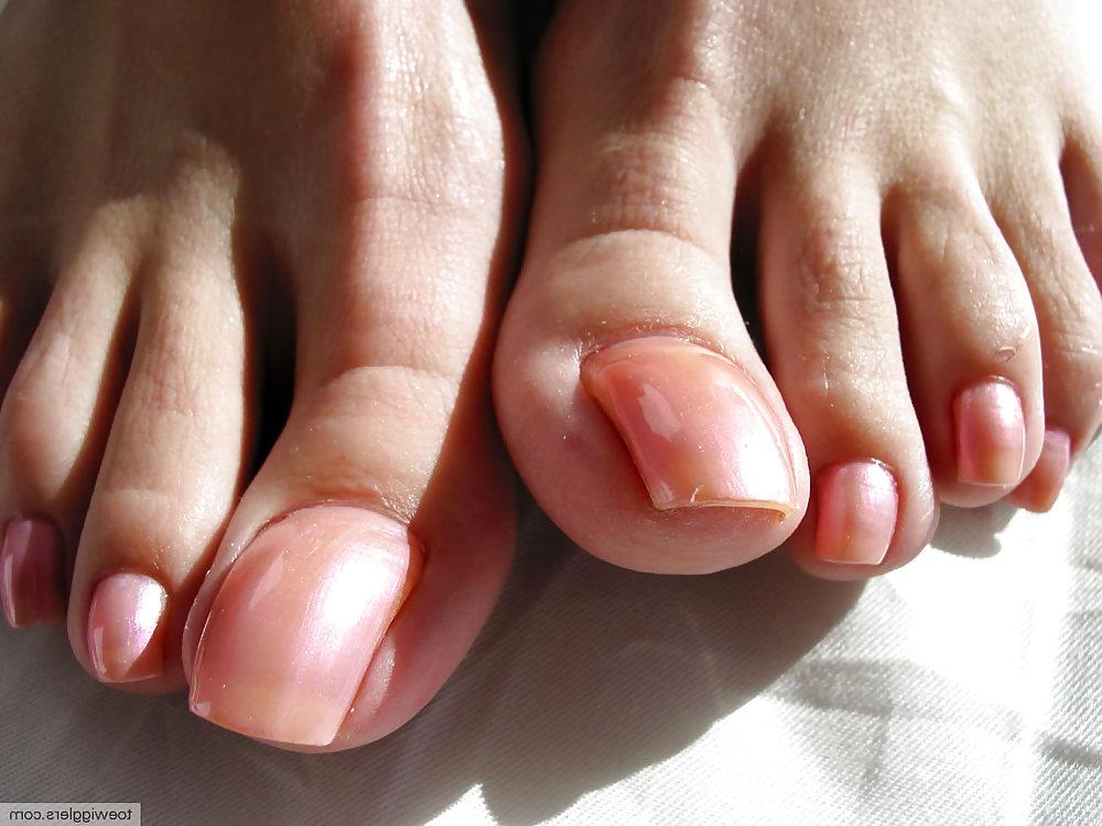 25P Long toenails and long toes