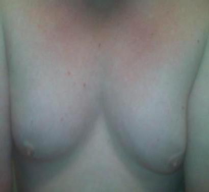 25P Hermaphrodite