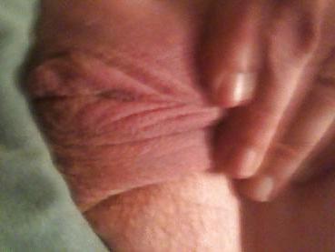 25P Hermaphrodite