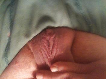 25P Hermaphrodite