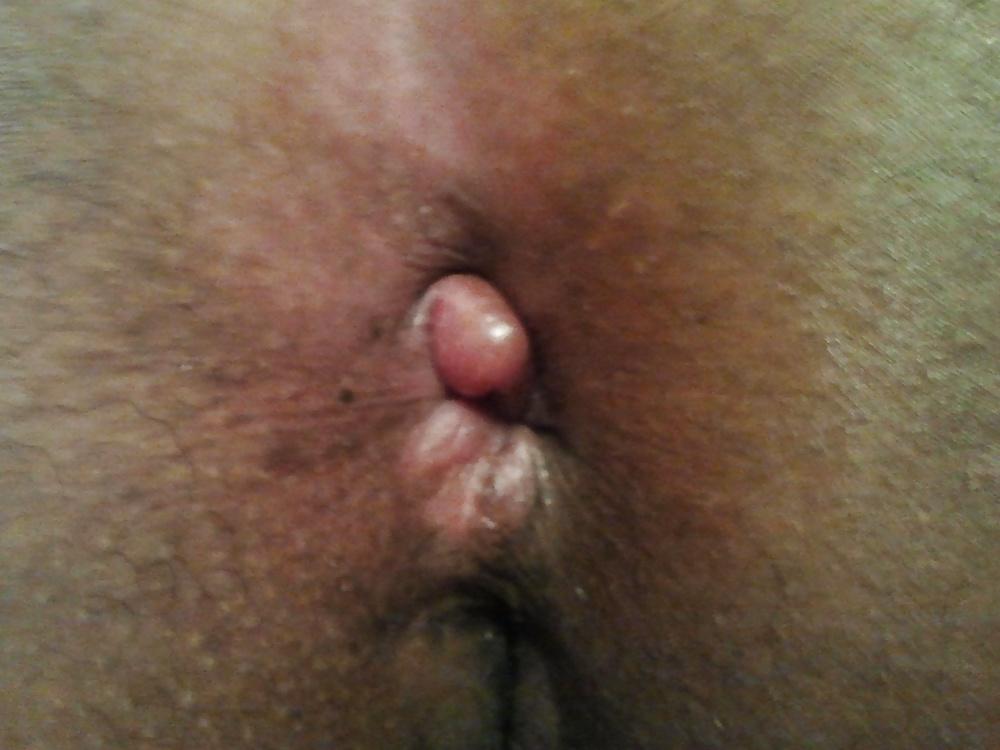8P Asshole before and after i stroked for a while