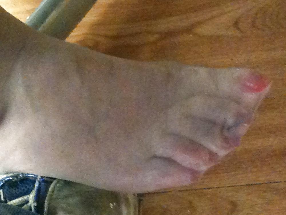 11P More feet