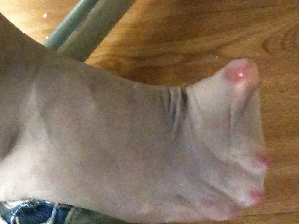 11P More feet