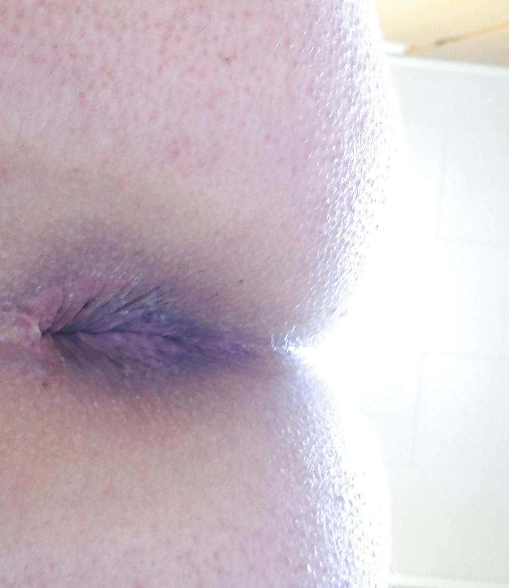 13P Mixed pics of my butthole from 18 until now