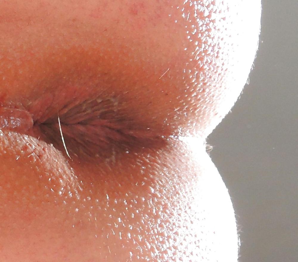 13P Mixed pics of my butthole from 18 until now