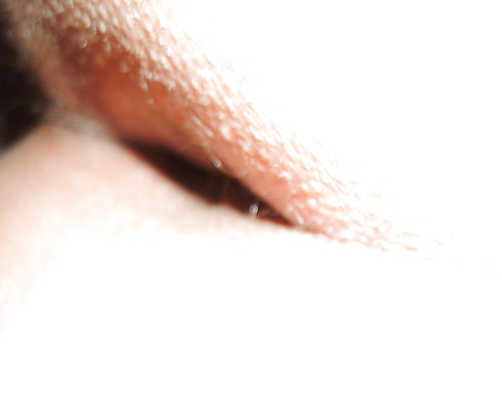 13P Mixed pics of my butthole from 18 until now