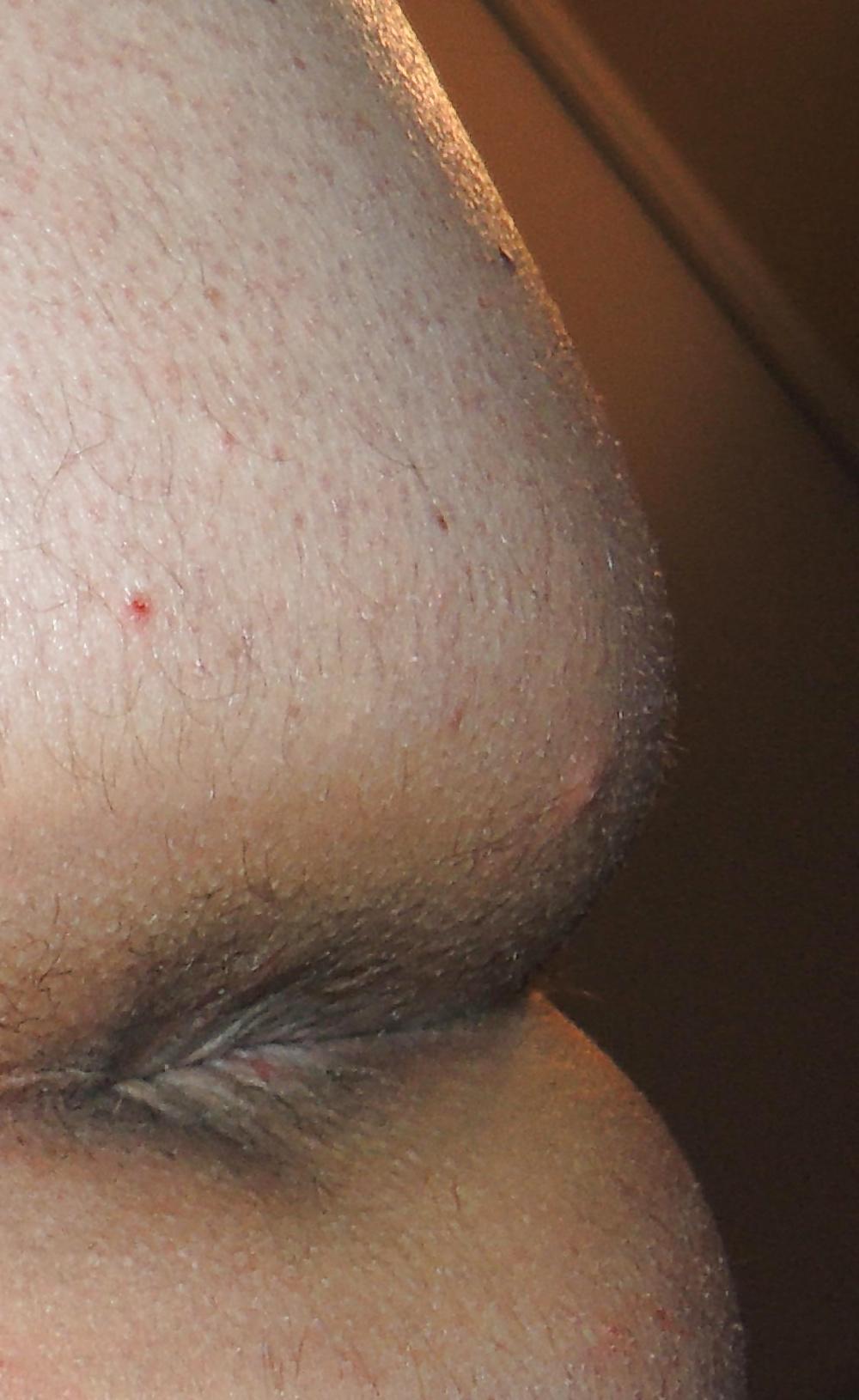 13P Mixed pics of my butthole from 18 until now