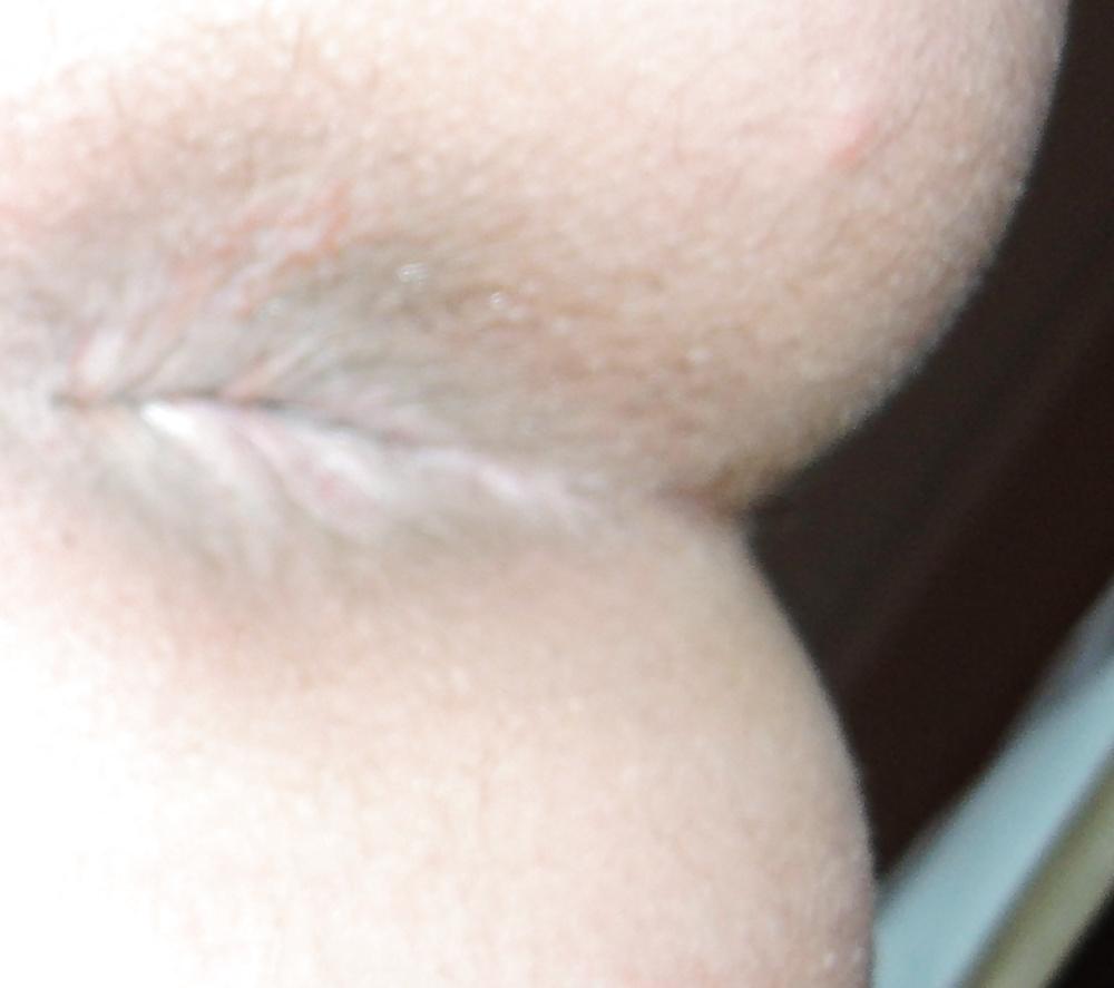 13P Mixed pics of my butthole from 18 until now