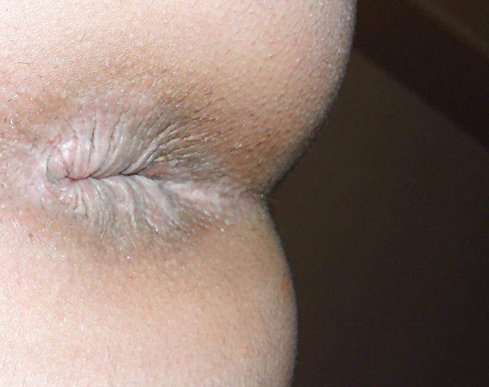 13P Mixed pics of my butthole from 18 until now