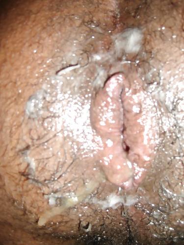 5P My Wet, Swollen, Gaping Asshole