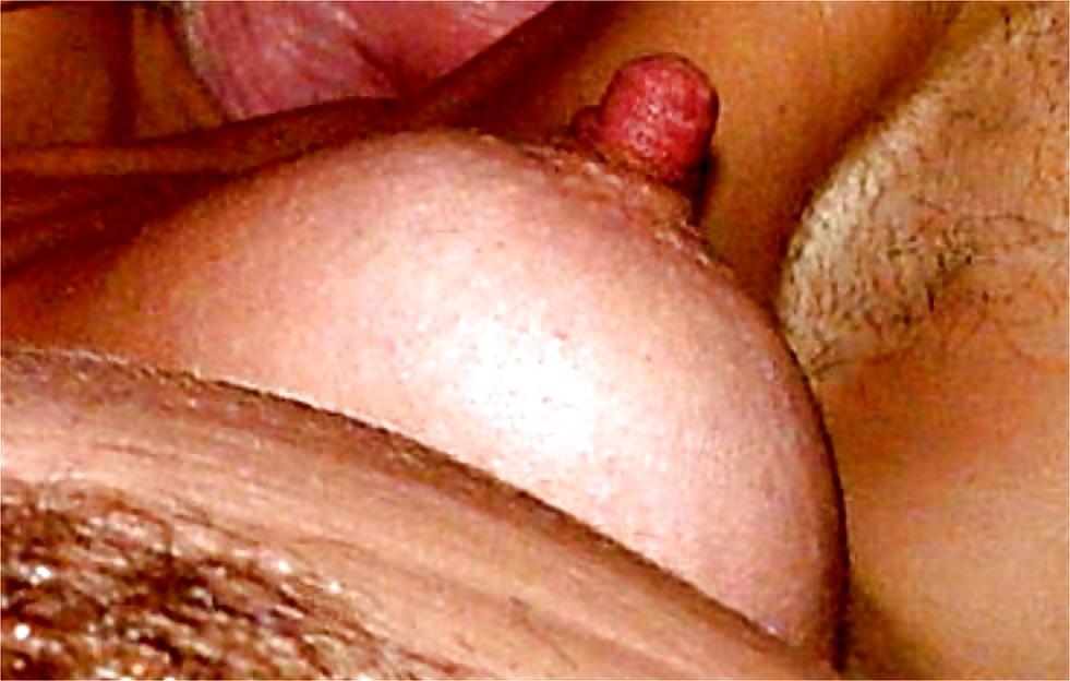 5P Lange Nippel