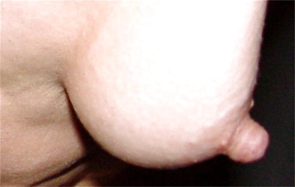 5P Lange Nippel