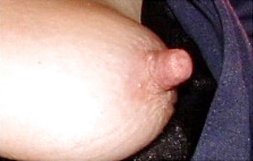 5P Lange Nippel