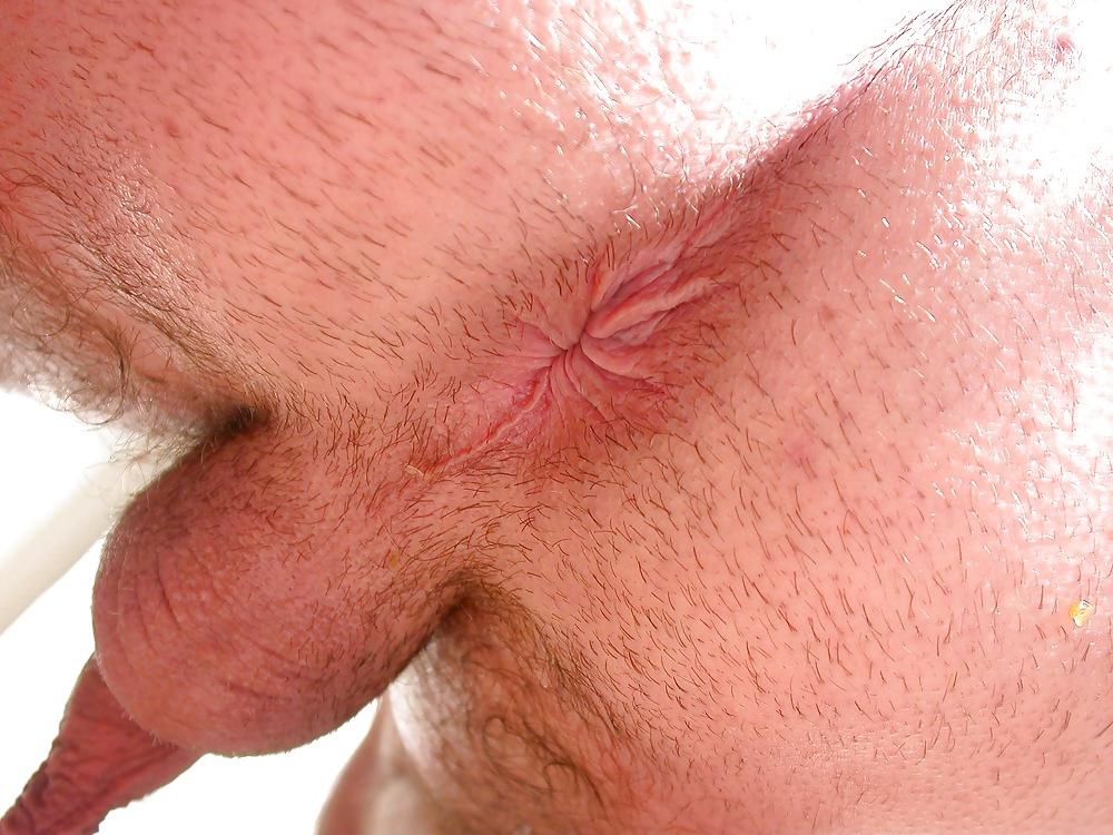 12P Asshole prolapse