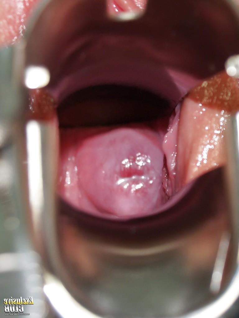 16P Pretty blonde Kristyna spreading vagina in front of her doctor