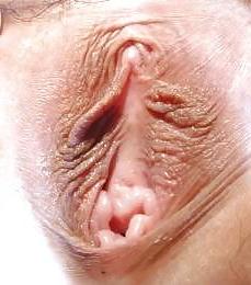 25P Cameltoe