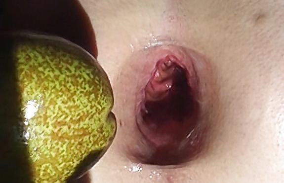 7P Giant gaping asshole  7,1cm gapes spread assfist 02.2011