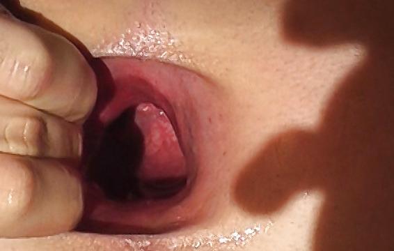 7P Giant gaping asshole  7,1cm gapes spread assfist 02.2011