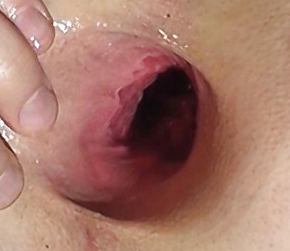 7P Giant gaping asshole  7,1cm gapes spread assfist 02.2011