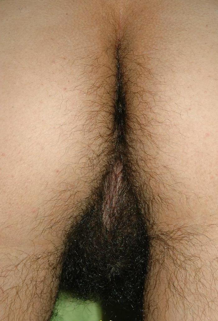 25P Mexican Hirsute Queen - 9- 9of9 - FIN