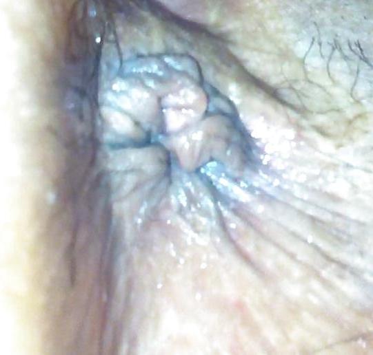 7P Wifes Asshole Closeup