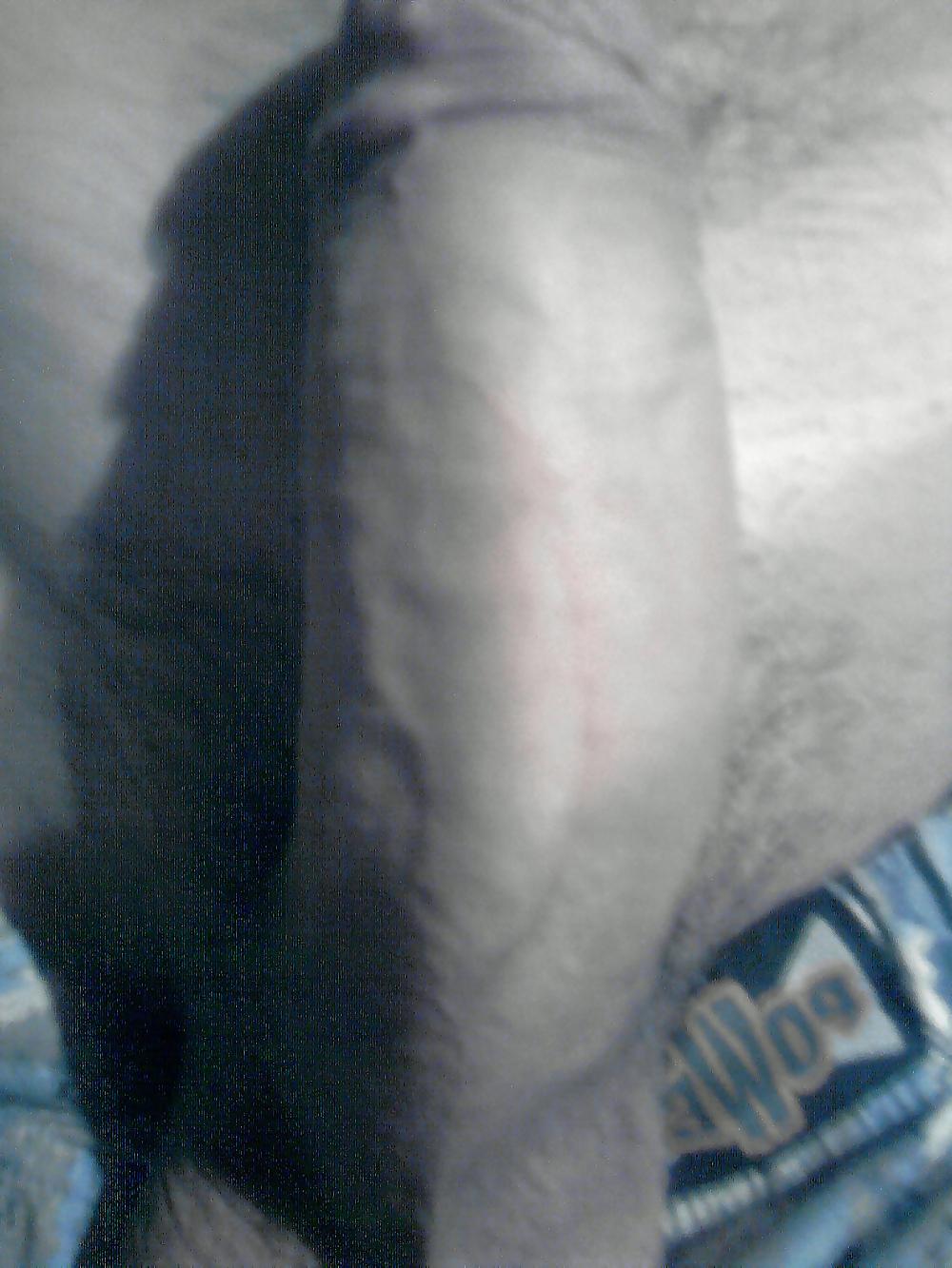 5P My penis :)