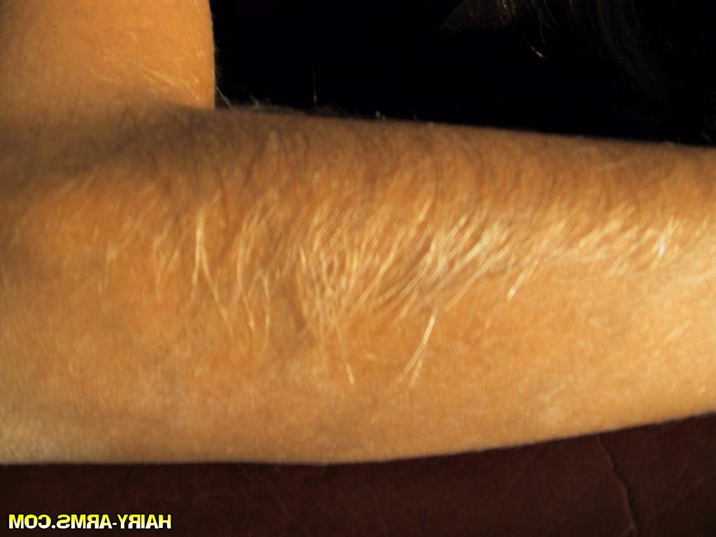 13P This Girls Arm Hair is Two Inches Long
