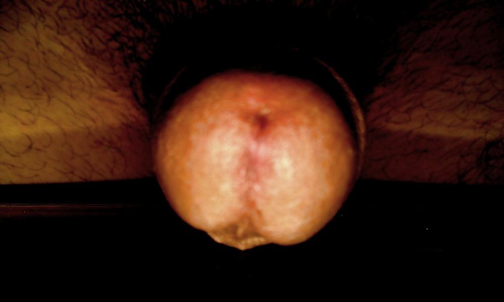8P Il mio pene 2