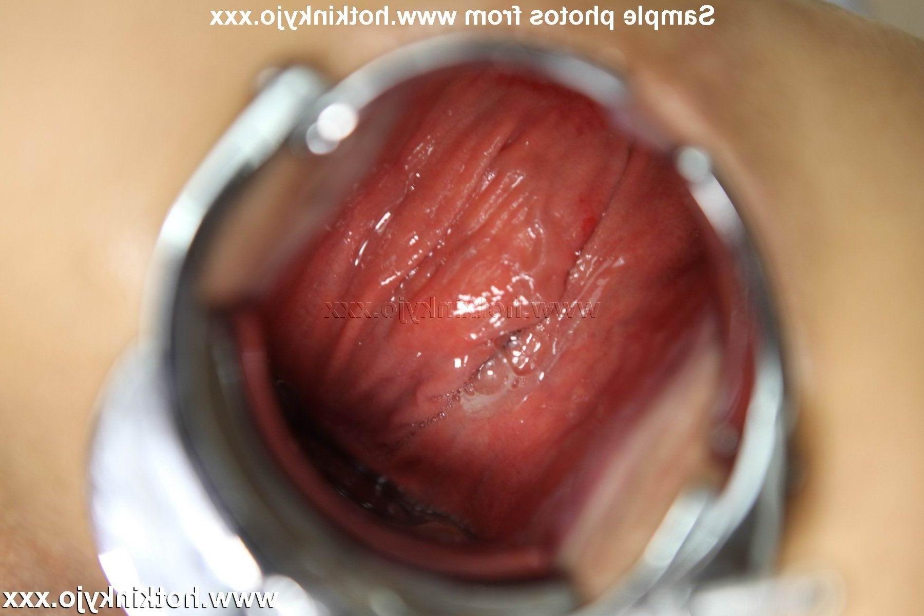 15P hotkinkyjo with xo speculum long dong in ass