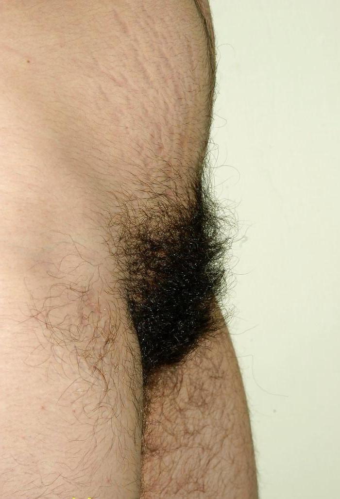 25P Mexican Hirsute Queen - 8- 8of9