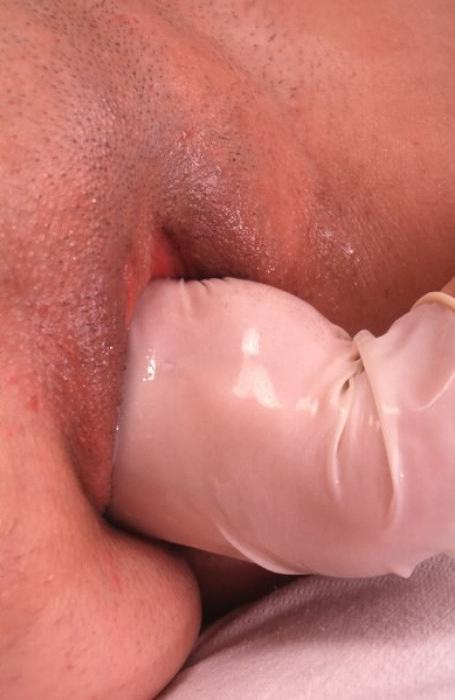 20P Doctor fisting brunets shaved pussy