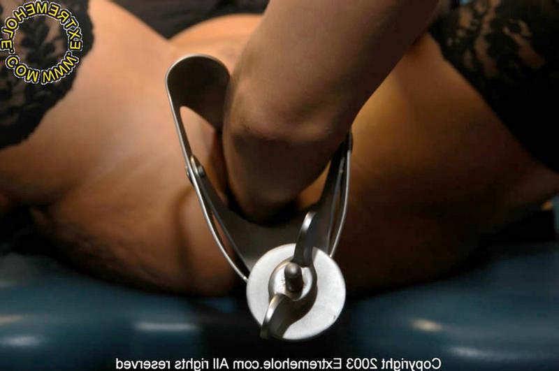 16P object insertion and fisting by the gyno doctor